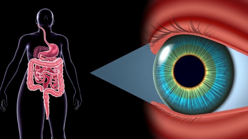 An illustration of the human gut with microbes and a diagram of the eye with retinopathy, highlighting the connection between gut health and eye disease.
